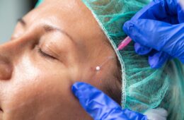 Blefaroplastie: ce este și când este recomandată?